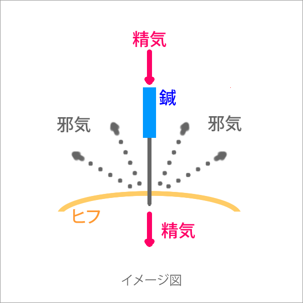 鍼のイメージ